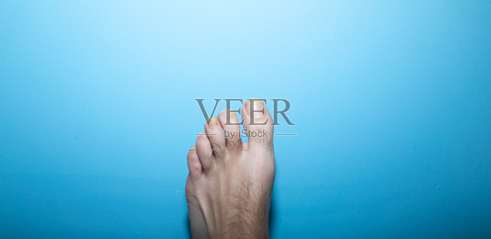 多毛的男人脚上的脚趾甲感染照片摄影图片