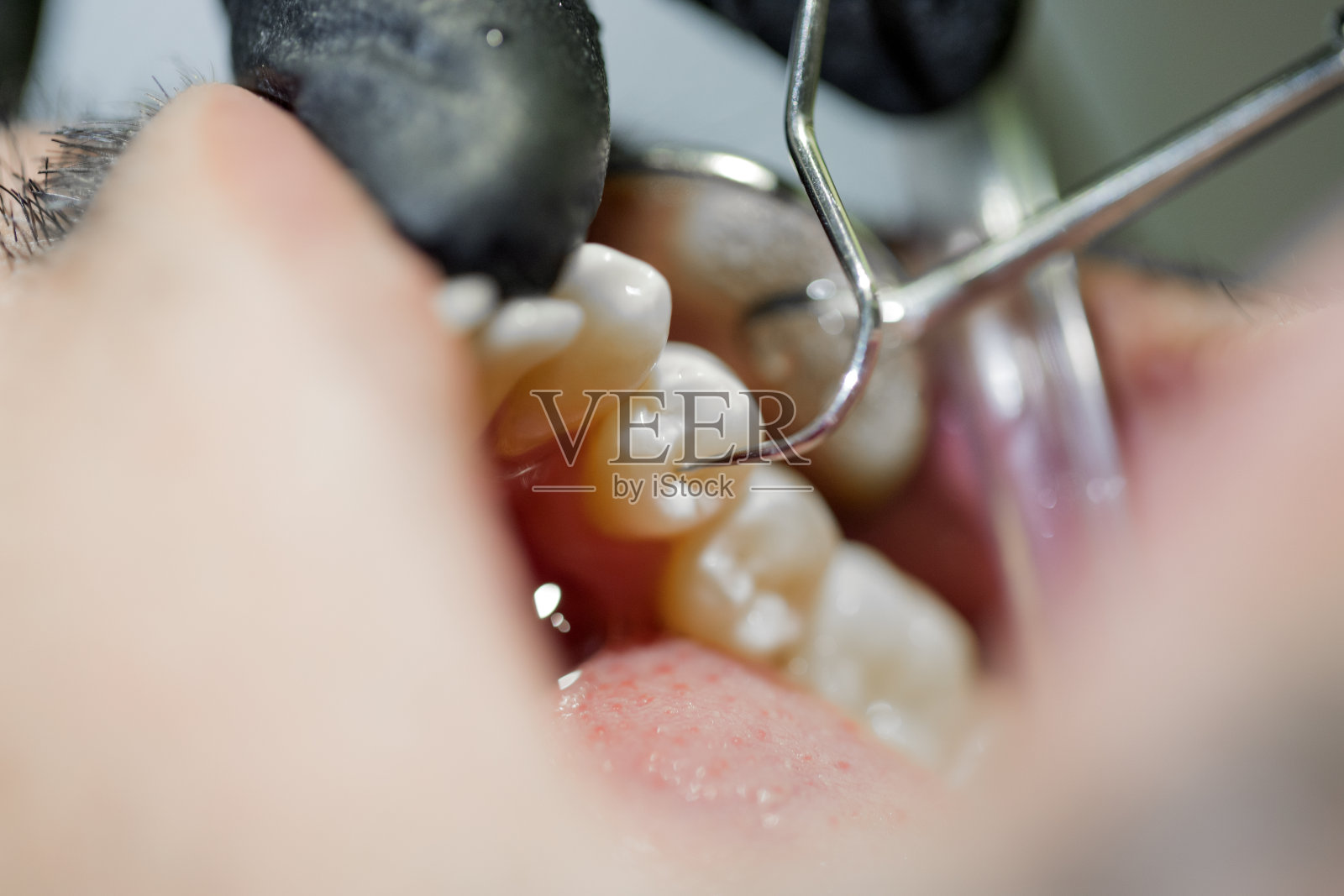 牙医清洁牙齿照片摄影图片