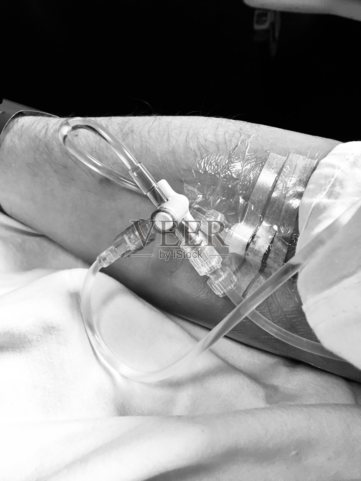 手臂灌注照片摄影图片