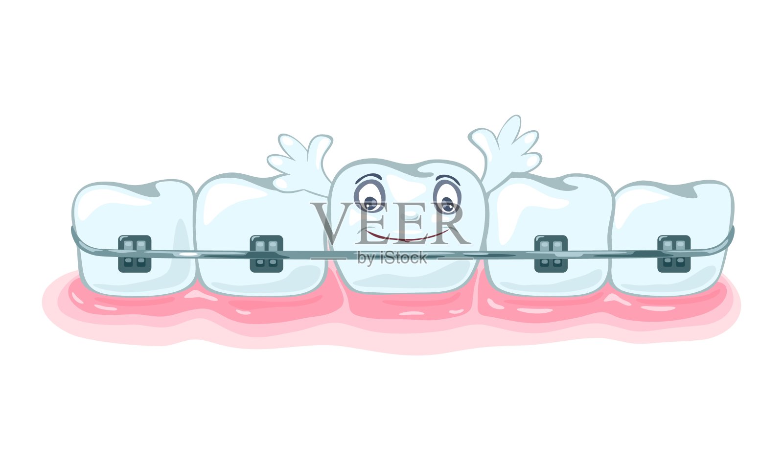 使用金属牙套、托槽矫正咬合,矫正牙列插画图片素材