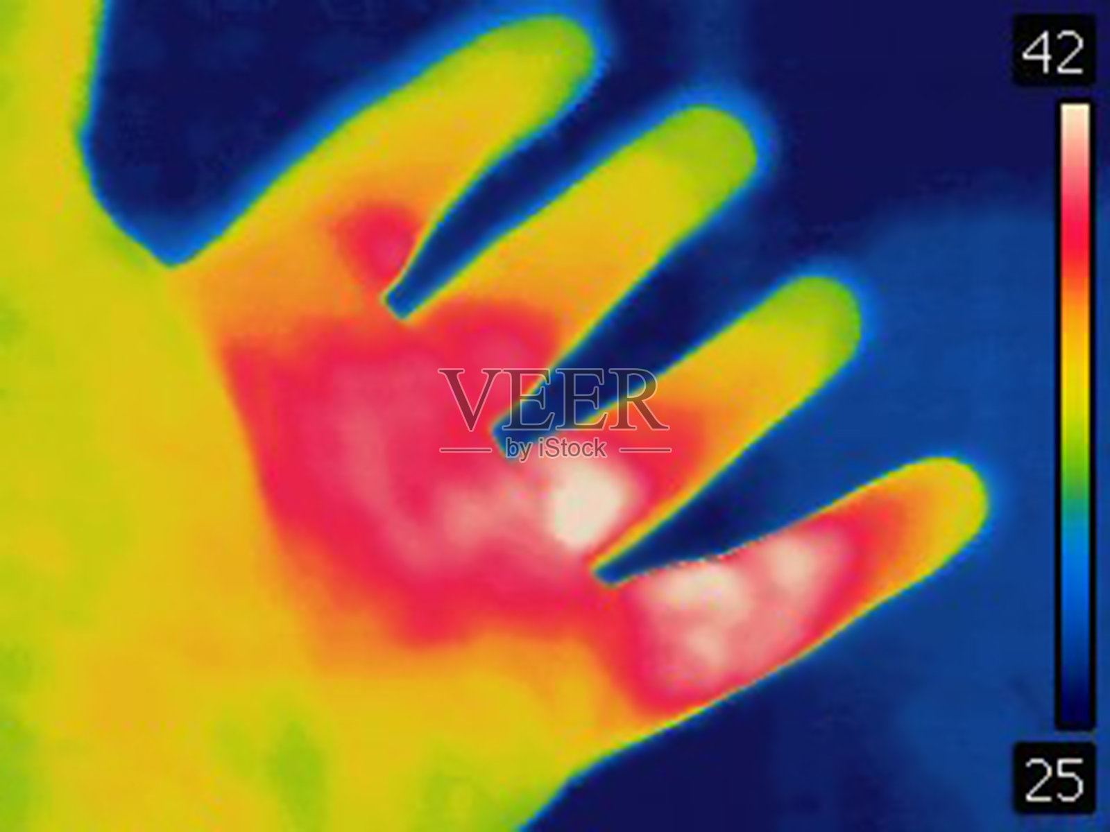 人手烧伤的热成像照片摄影图片