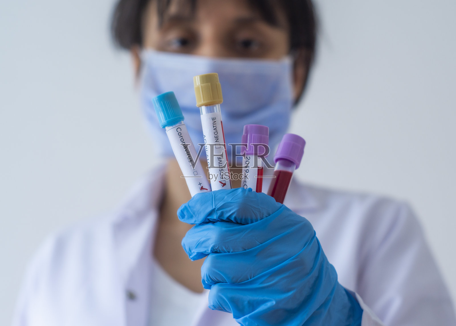 新型冠状病毒阳性照片摄影图片