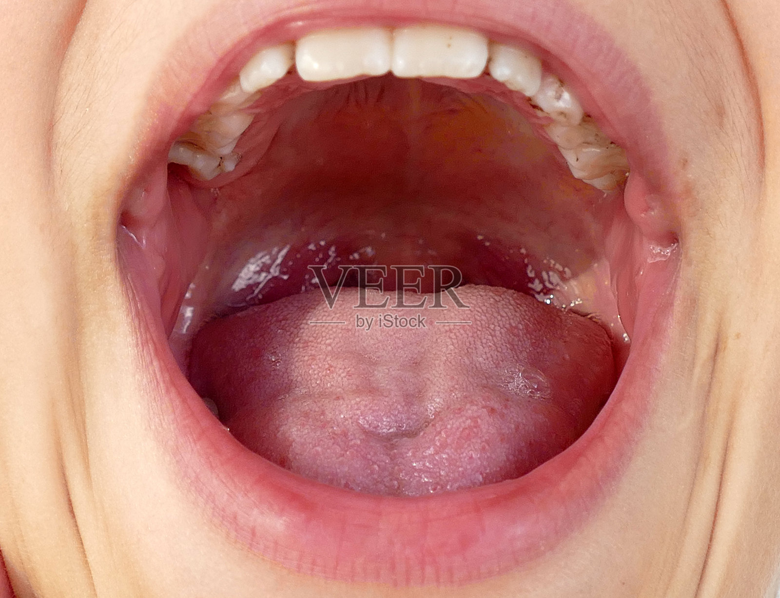 口腔健康和扁桃体炎的儿童,照片摄影图片