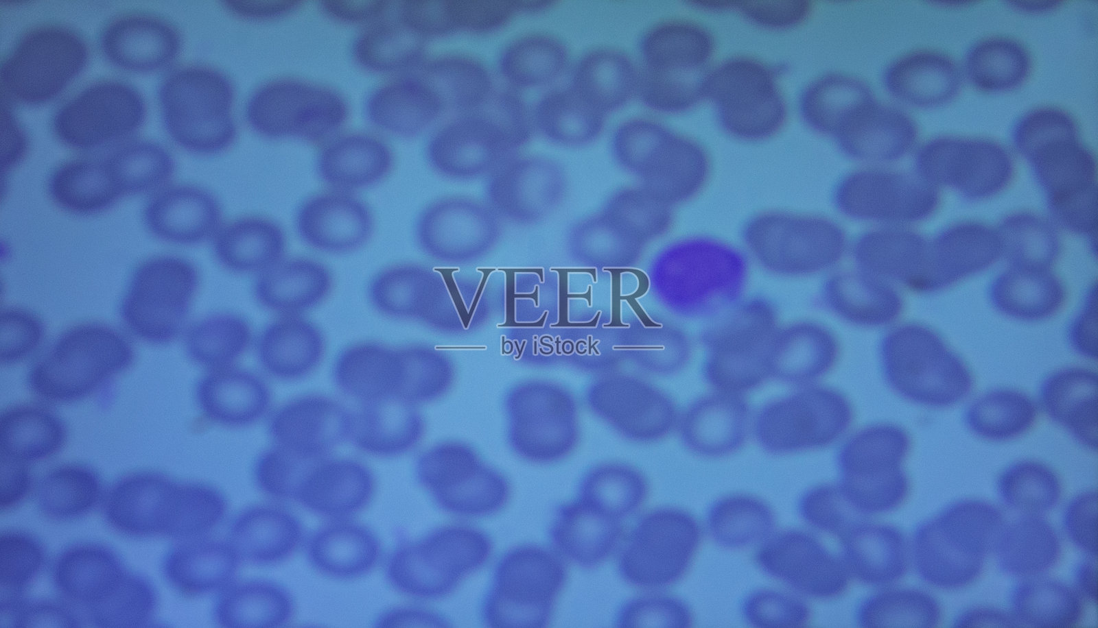 电脑屏幕上显微镜下的白细胞特写照片摄影图片