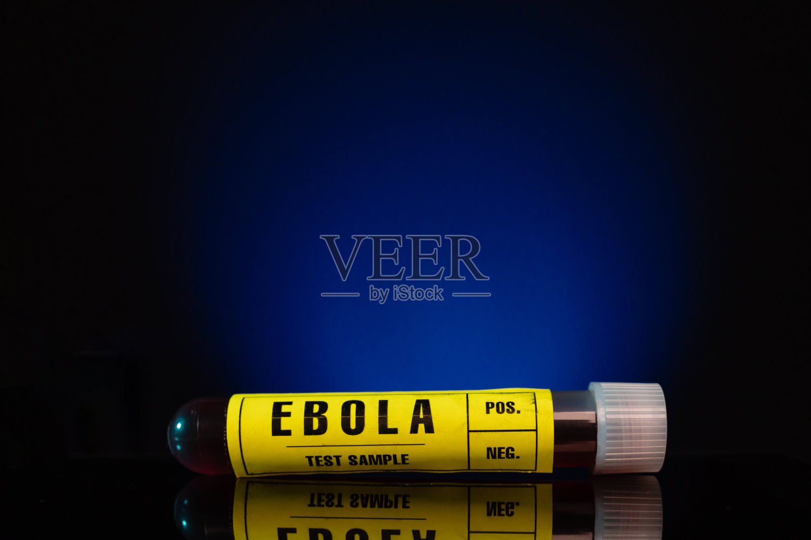 埃博拉病毒血液测试样本管特写,黄色标签,蓝色背景照片摄影图片