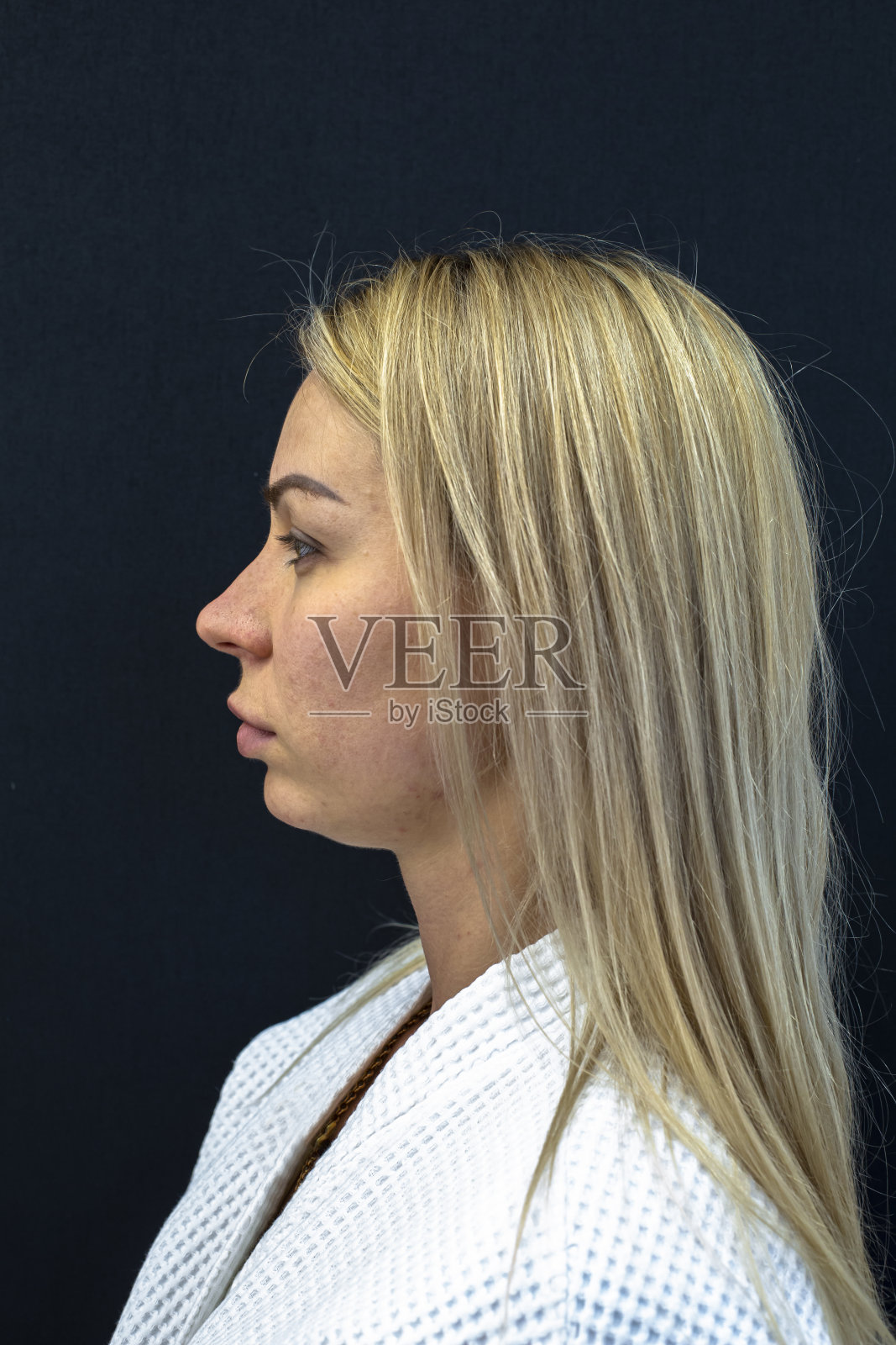 年轻女性的痤疮问题特写照片摄影图片