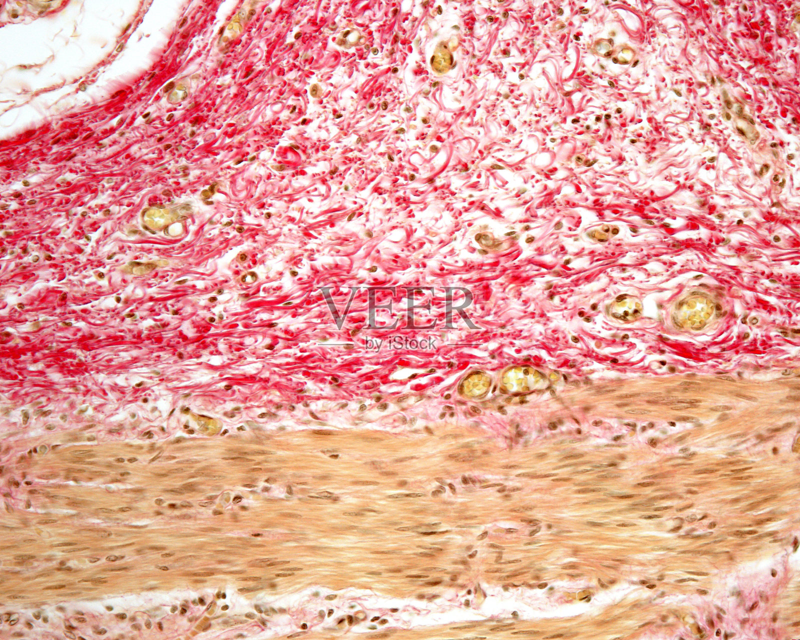 食道。胶原纤维照片摄影图片