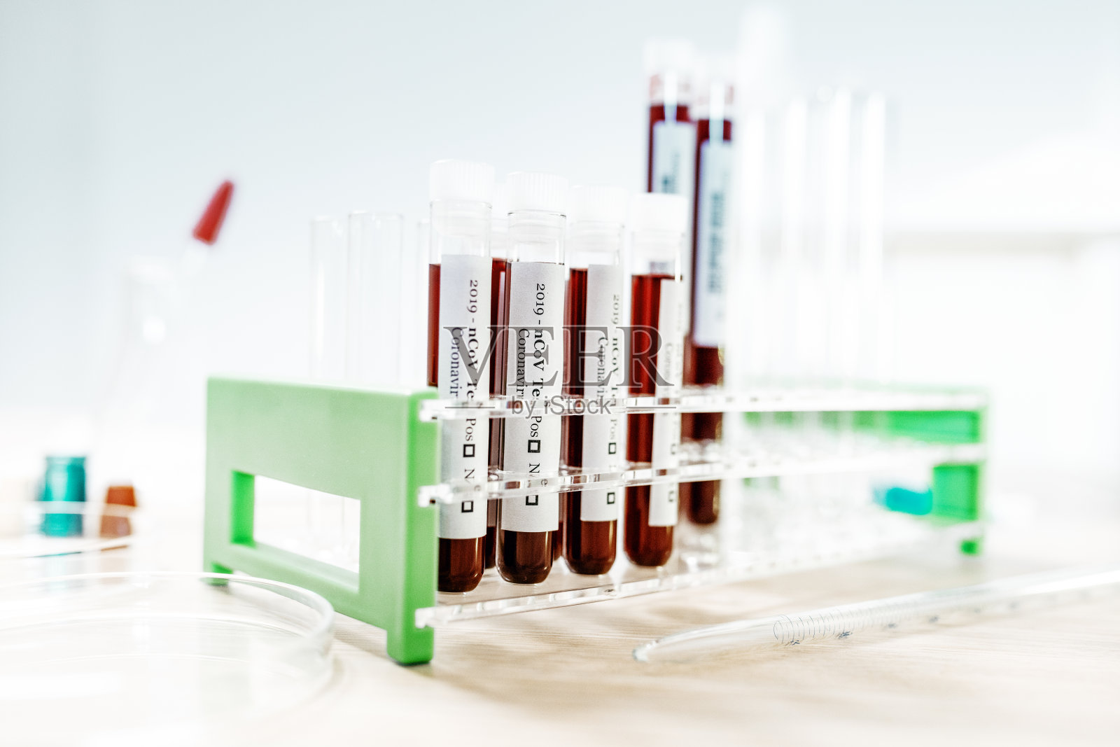 实验室试管中的血液照片摄影图片