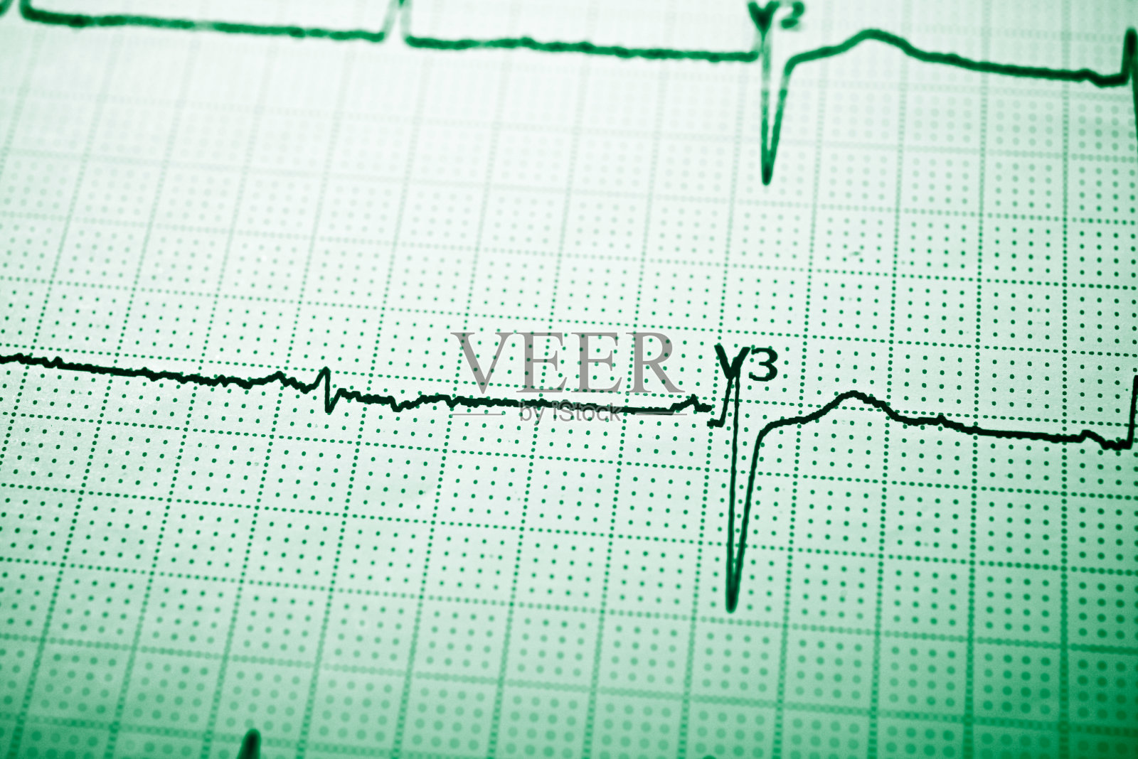 绿色的心电图照片摄影图片