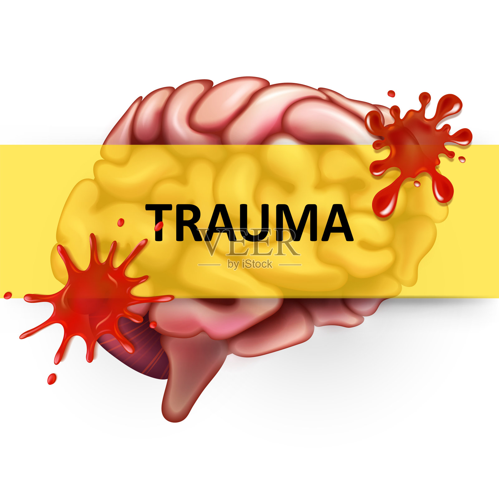 大脑疾病和创伤插画图片素材