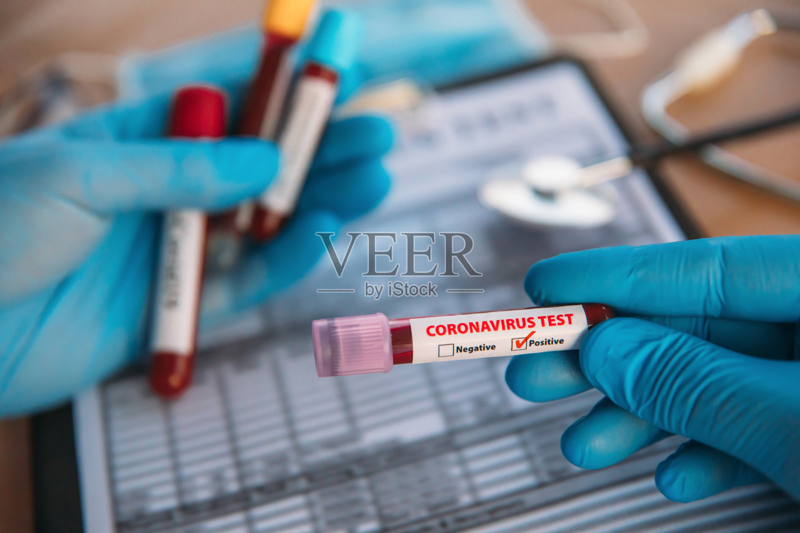 医生持有大流行性冠状病毒2019-nCoV血样阳性试管。照片摄影图片