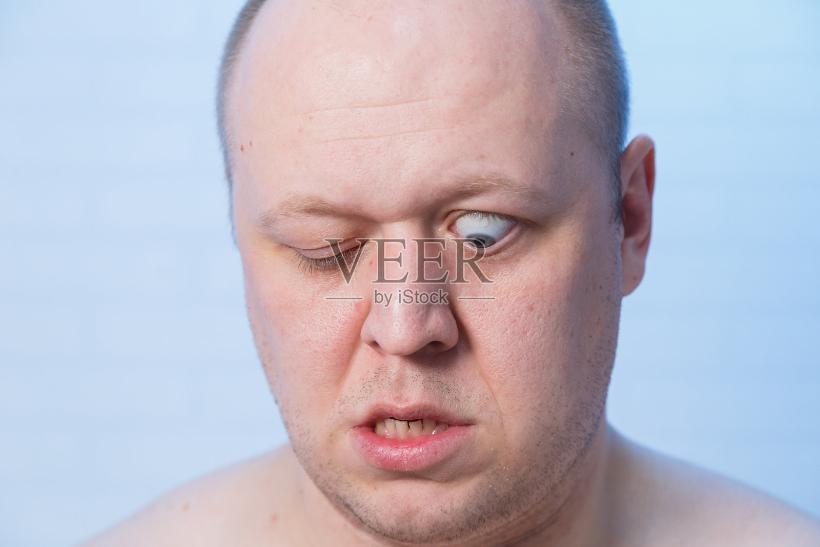 一个眼睛鼓起来的秃头男人的肖像照片摄影图片