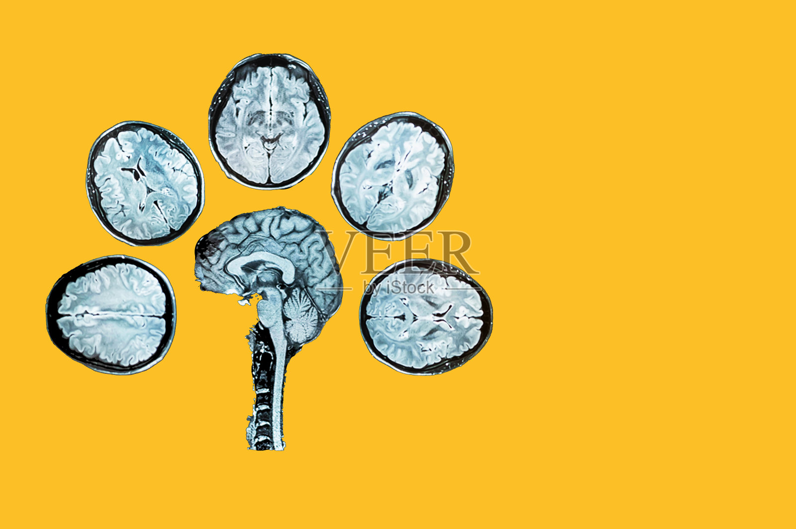 头部磁共振成像,黄色背景。及时检测头部疾病的概念。心理健康。照片摄影图片