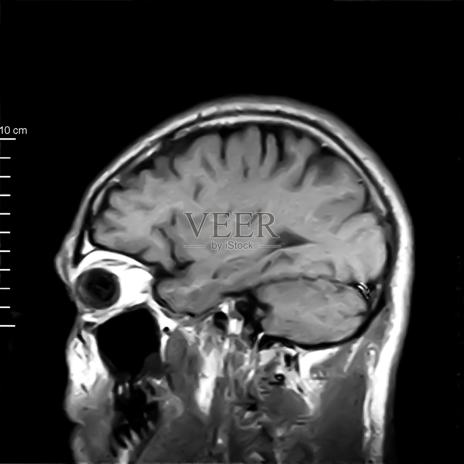 颅骨核磁共振成像照片摄影图片