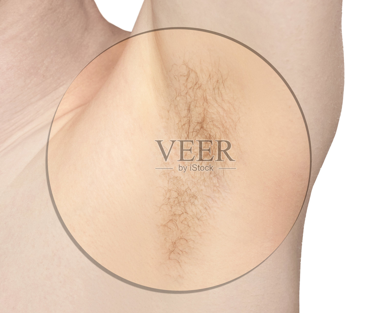 女孩腋下。白人腋窝。脱毛前后。照片摄影图片