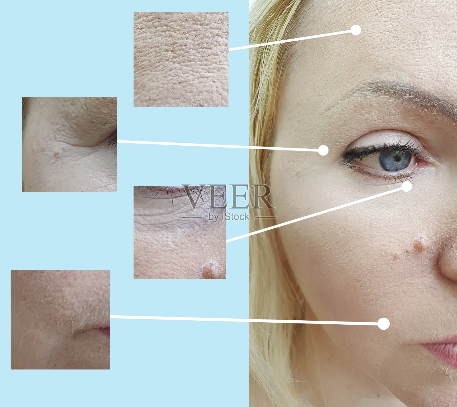 女人脸部皱纹前后拼贴治疗照片摄影图片