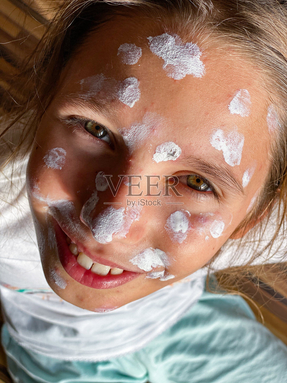 满面笑容的水痘女孩的肖像照片摄影图片