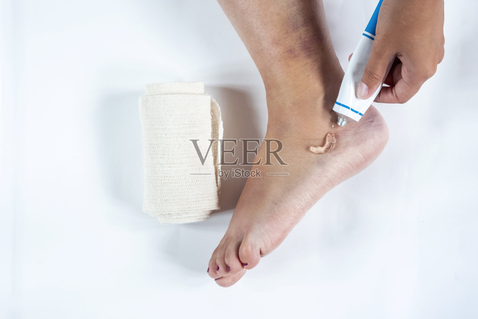 一名女子正在用白色背景隔离的弹性绷带在脚踝扭伤的腿上涂抹凝胶。脚踝扭伤,白色背景上有淤青。运动员跑步训练事故。照片摄影图片
