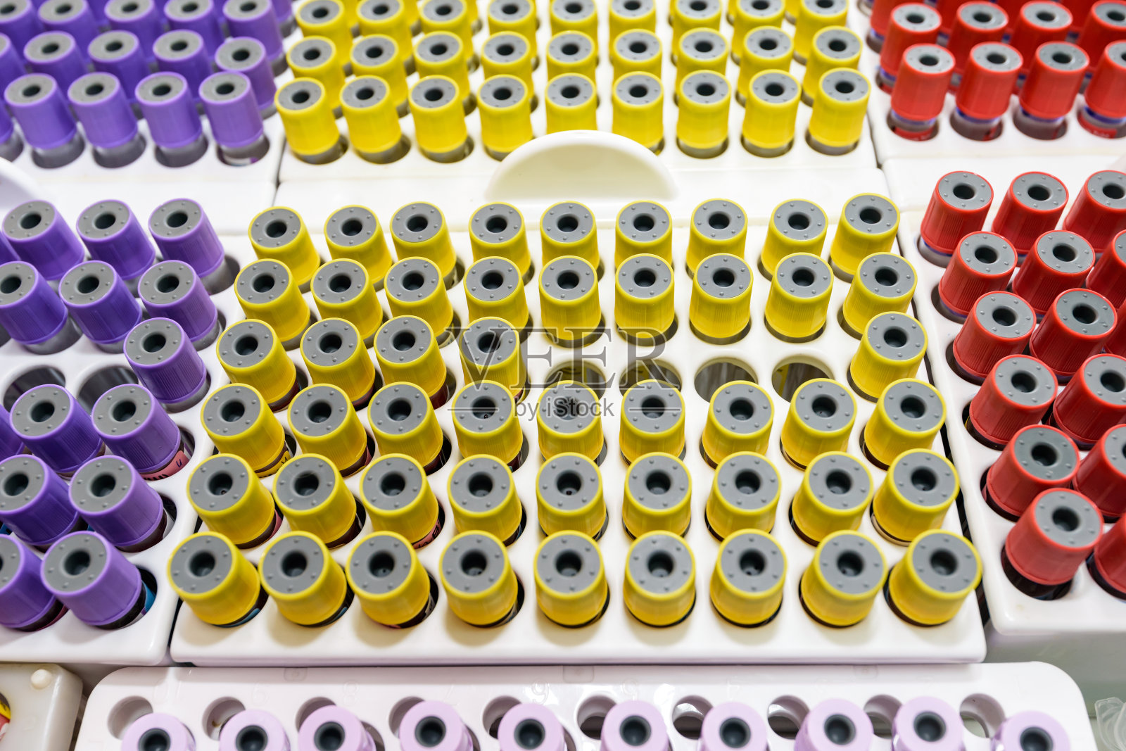 血液采集室的血液试管。照片摄影图片