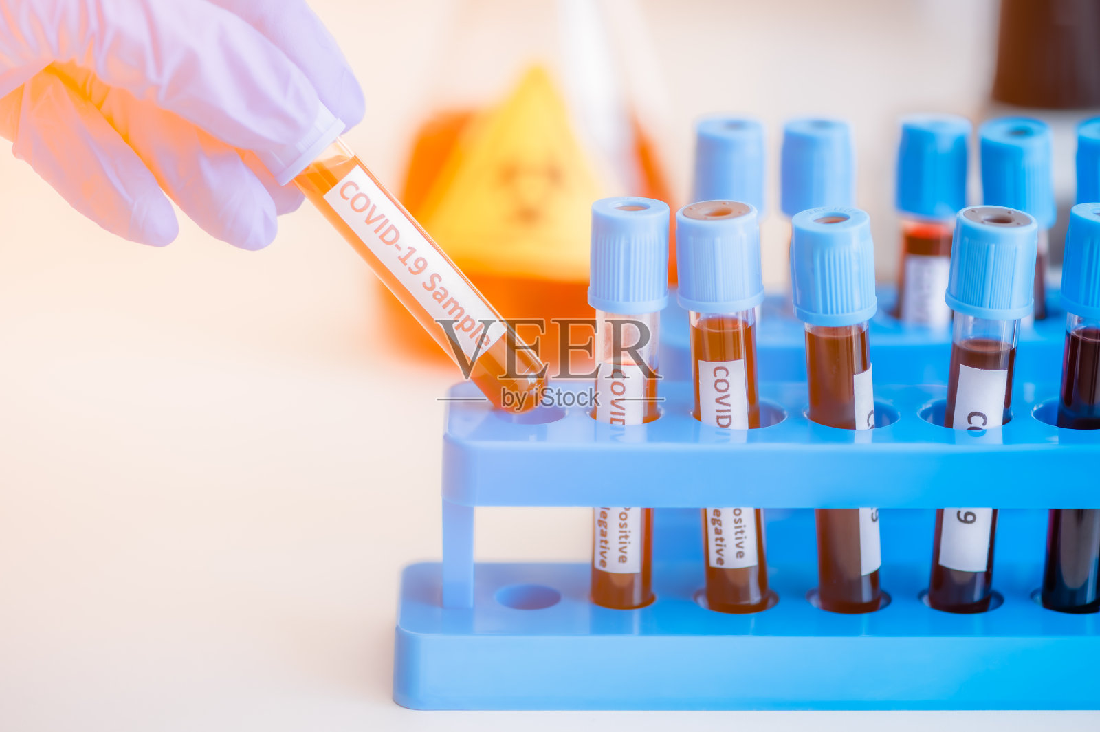 冠状病毒或covid-19试管血液检测照片摄影图片