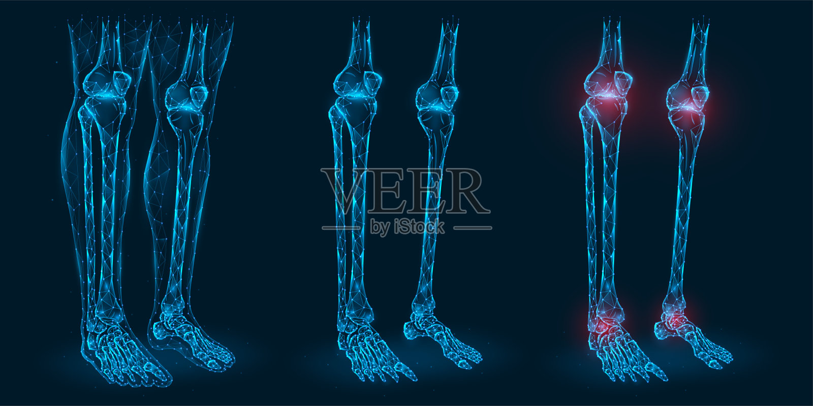 疼痛,损伤或炎症在膝盖和脚踝多边形矢量插图。膝关节和踝关节病变的低聚模型。插画图片素材