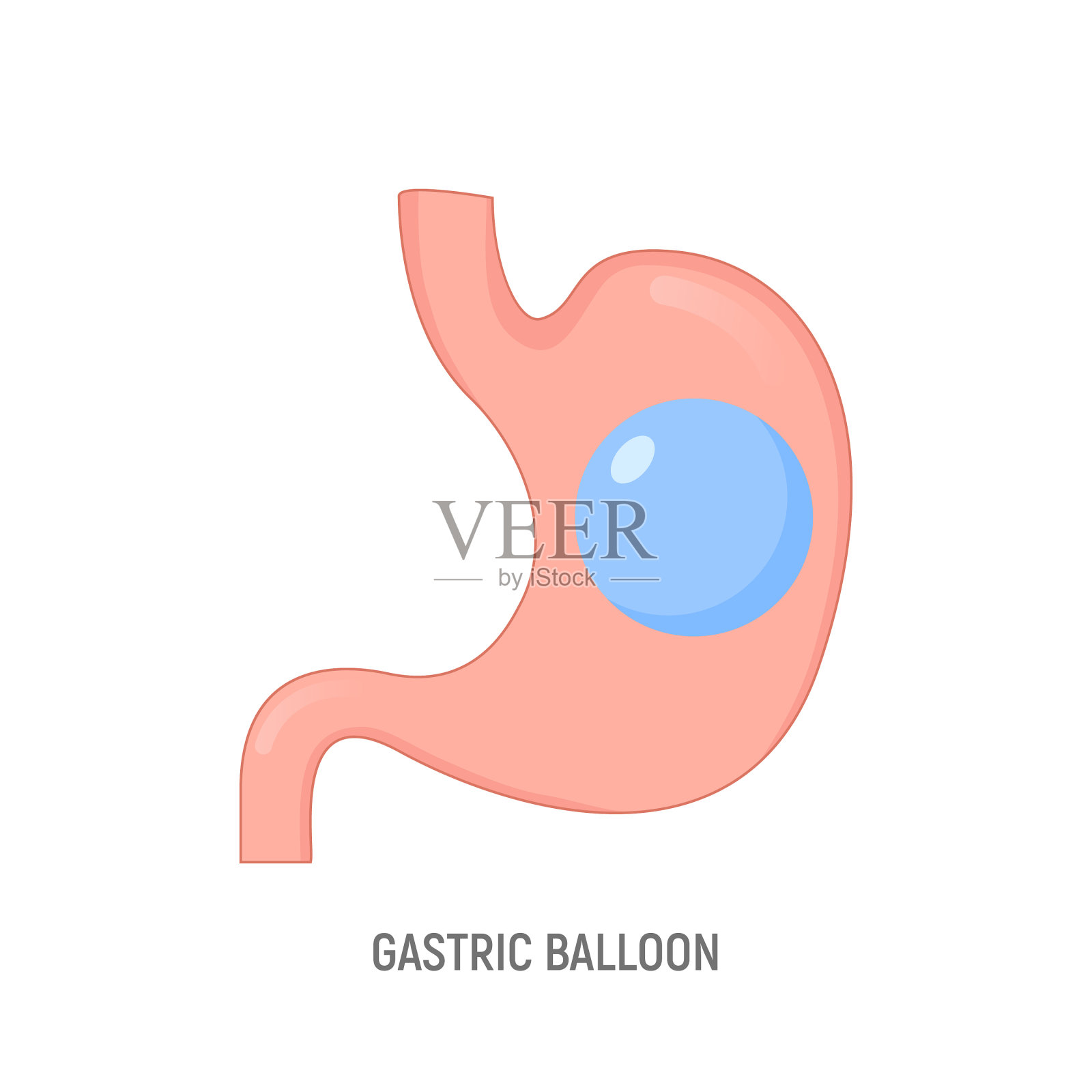 胃球囊减肥胃内手术插画图片素材
