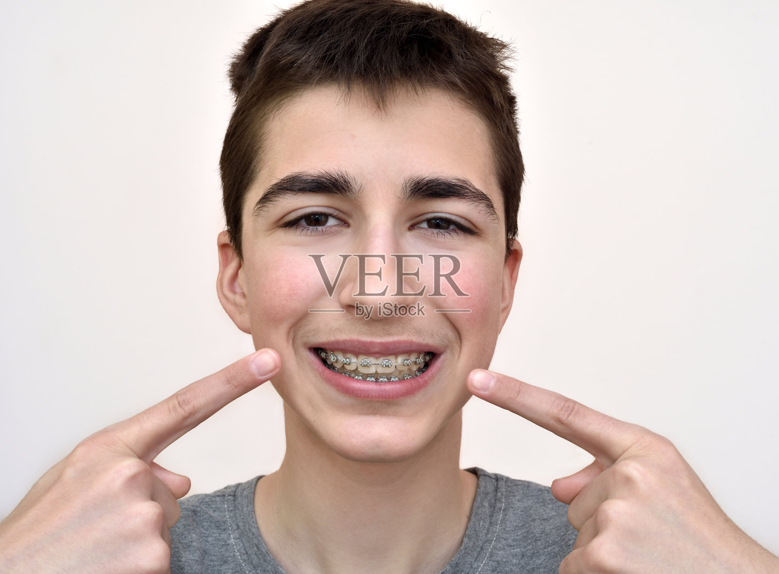 戴着牙套的少年照片摄影图片