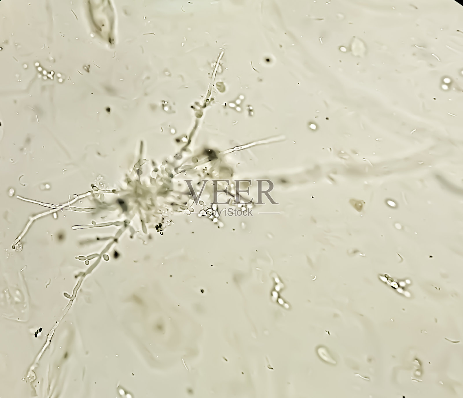 真菌感染;白色念珠菌芽殖酵母和假菌丝。这种真菌通常影响阴道和外阴,口腔(鹅口疮)和尿布疹。显微图像100 x。特写视图照片摄影图片