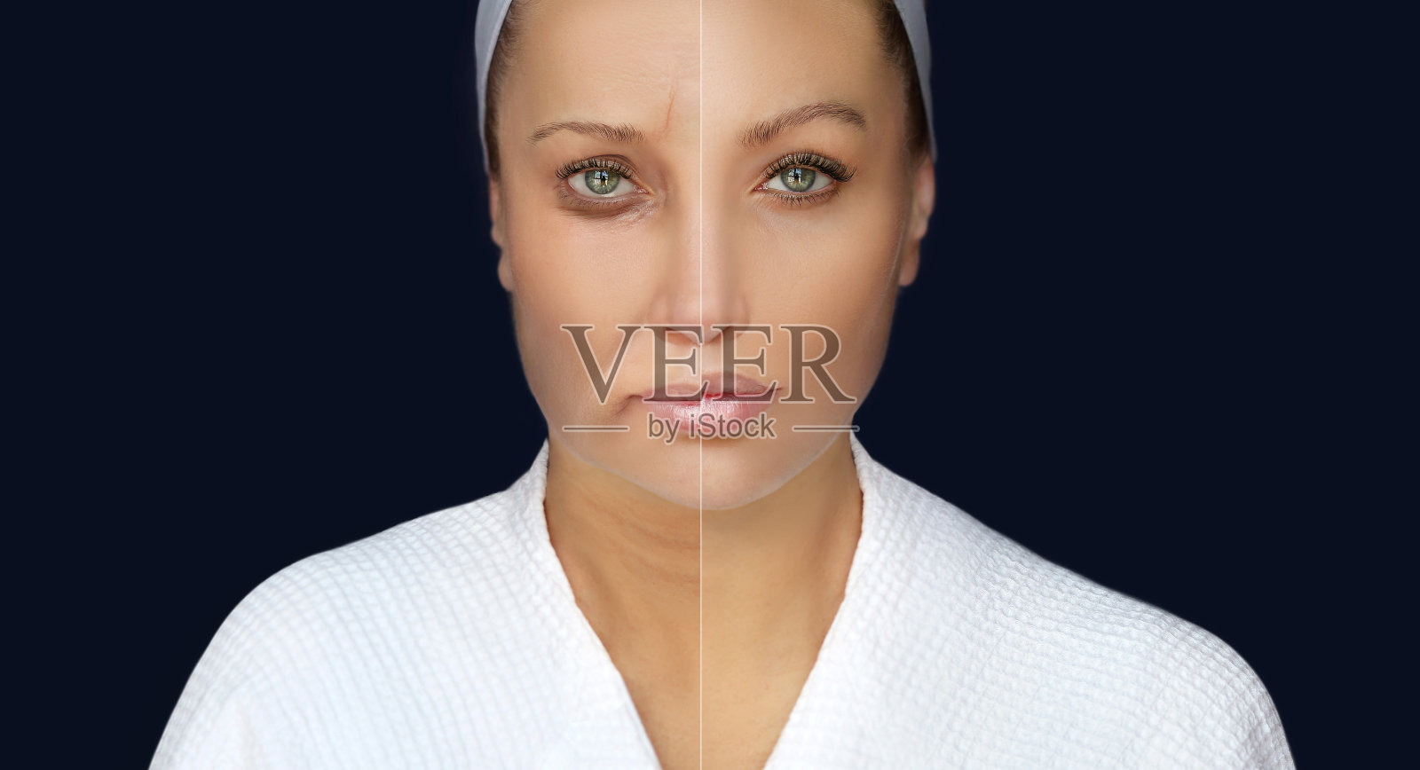 整形手术的结果。皱眉线,鼻唇线,颈部,眼圈下,颈部线。照片摄影图片