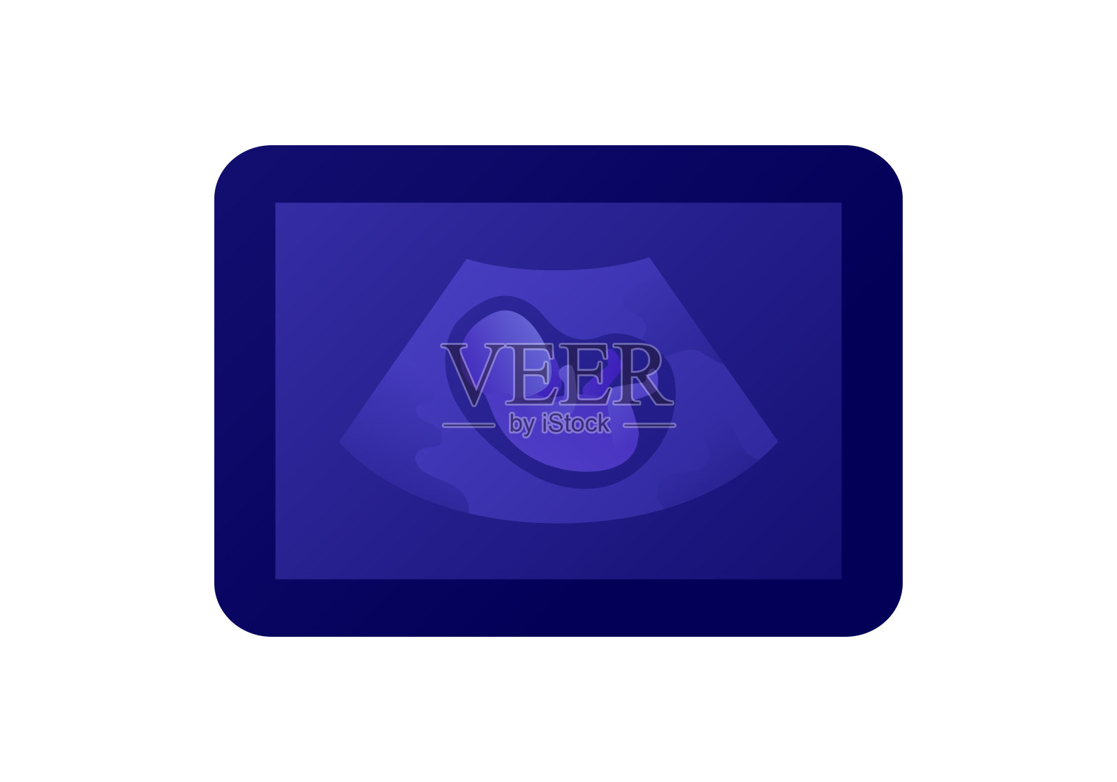 超声妊娠诊断概念。矢量平面插图。子宫中的婴儿在设备屏幕上隔离白色背景。医疗保健设计。插画图片素材