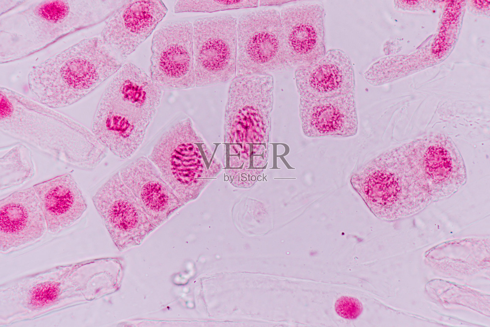 洋葱根尖有丝分裂细胞的显微镜观察。照片摄影图片