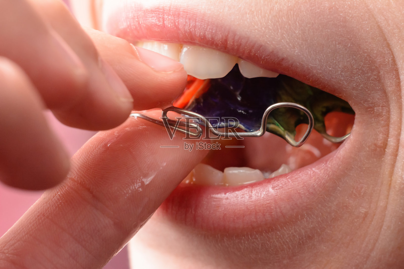 一个为牙齿竖立而装饰金属板的大计划照片摄影图片