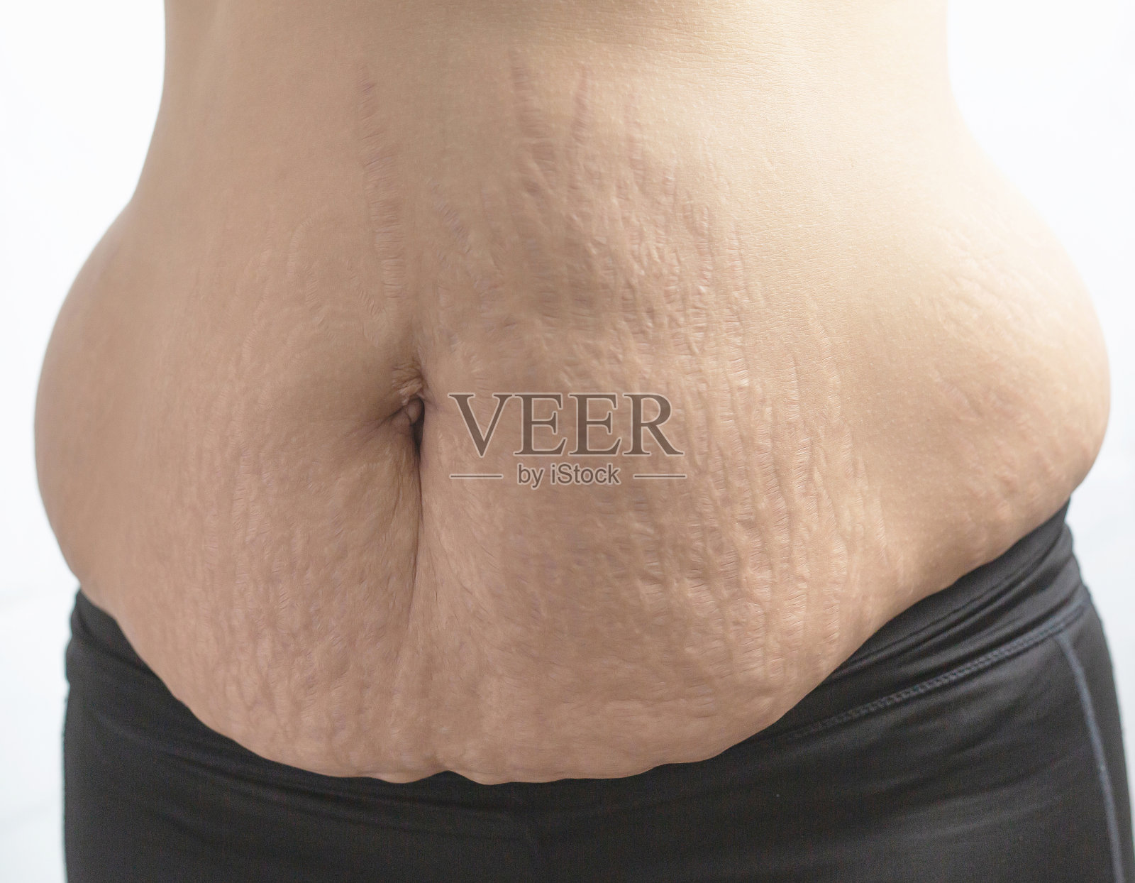 肥胖的女人需要控制体重,她有多余的脂肪。照片摄影图片