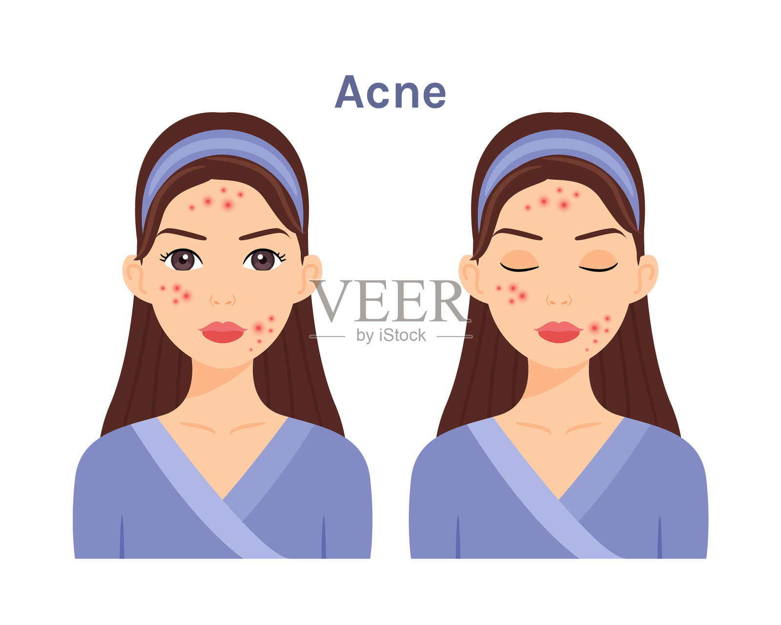 美丽的女人与痤疮问题皮肤插画图片素材