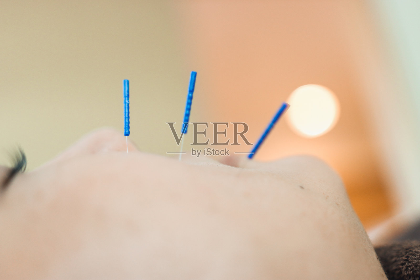 亚洲女性面部美容针灸照片摄影图片