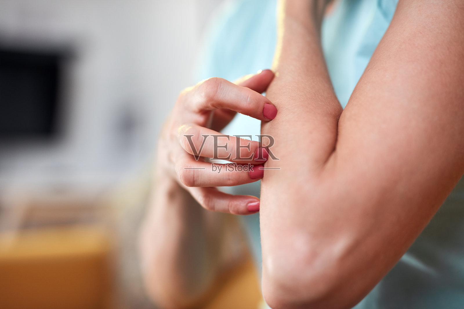 女人发痒,刺痛的手臂抓挠皮肤。照片摄影图片