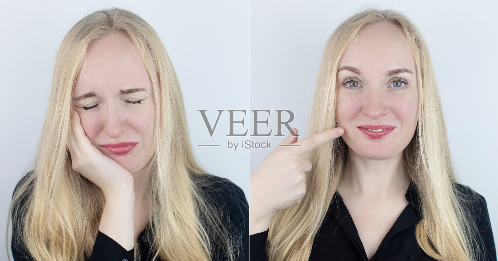 之前和之后。在左边,女人表示牙疼,在右边,表示牙齿不再疼了。牙痛。疼痛管理和专业医疗护理援助的概念。照片摄影图片