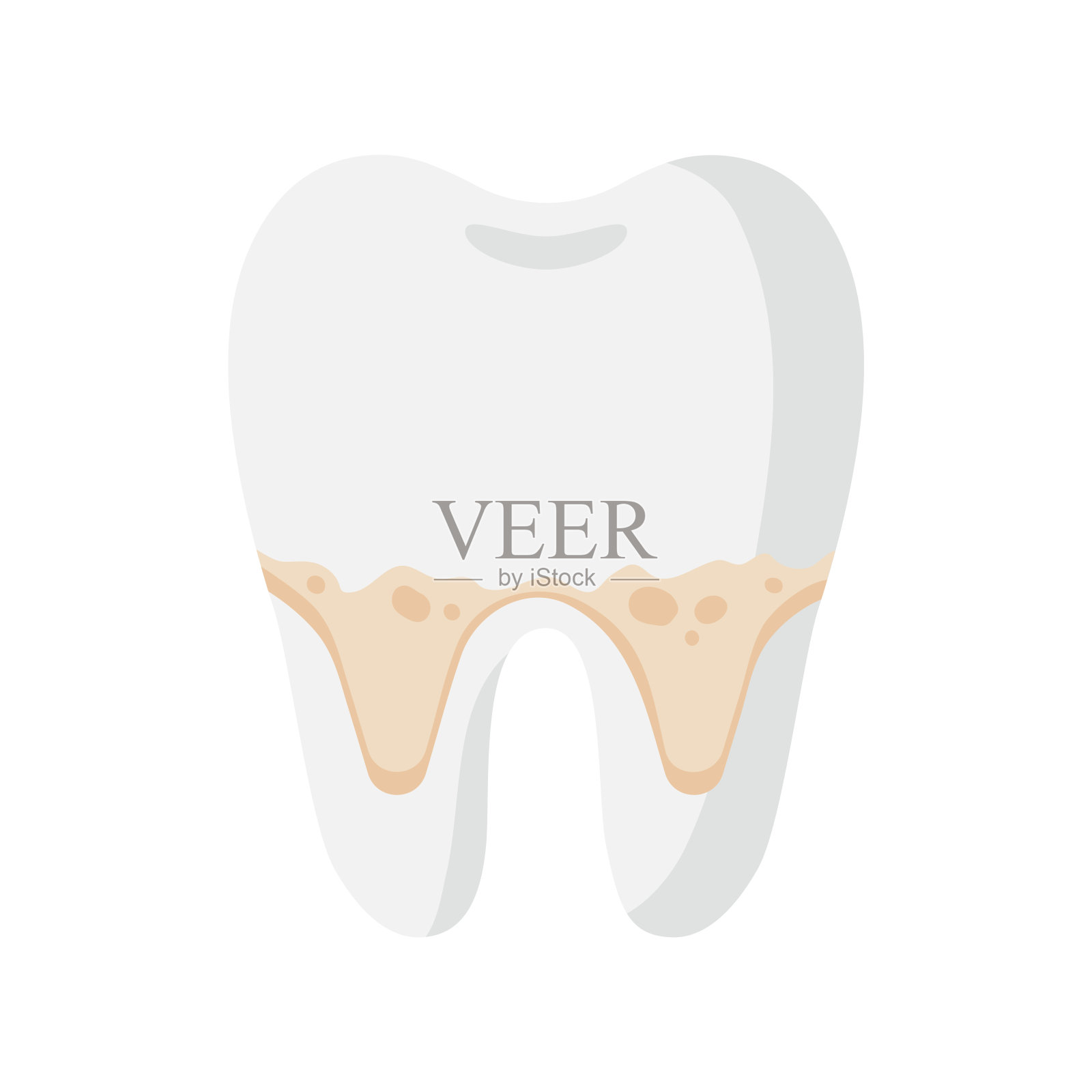 载体卡通牙齿有牙根菌斑和牙垢病。插画图片素材