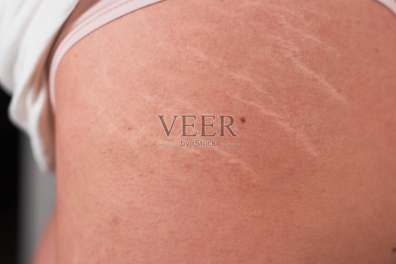 腿上有妊娠纹的黑发女人的细节。身体积极的概念。照片摄影图片