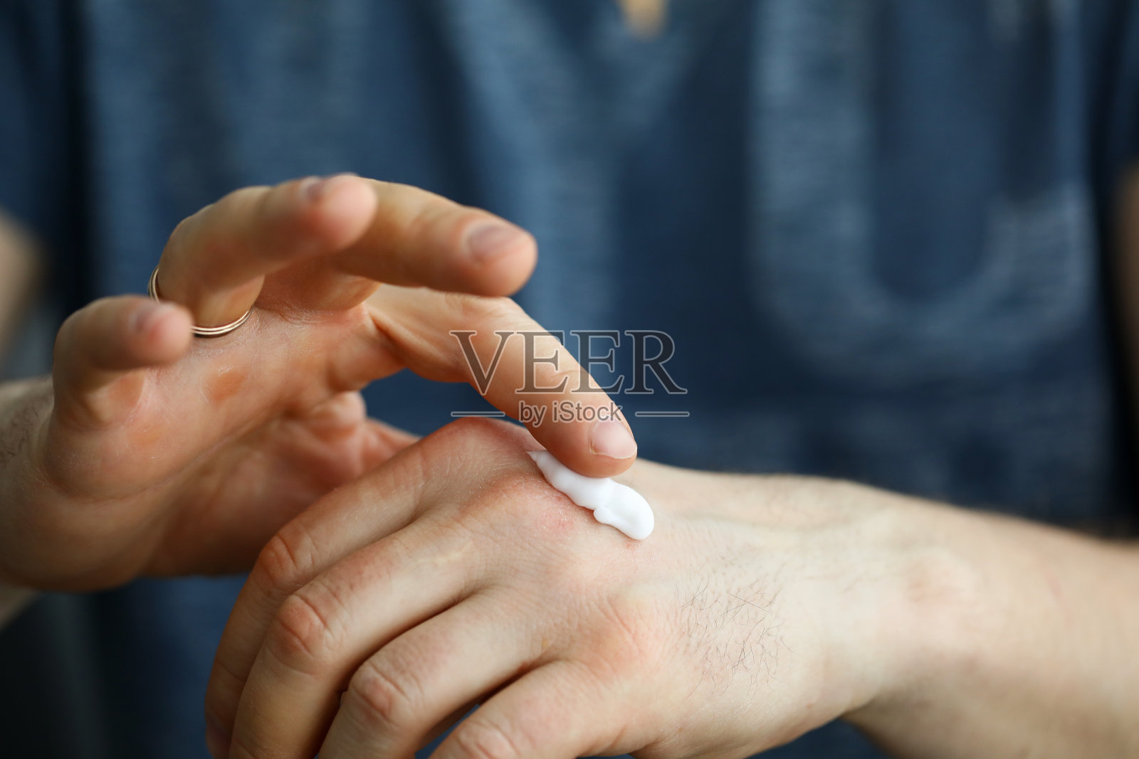 男性坚硬有老茧的手要涂抹保湿霜照片摄影图片