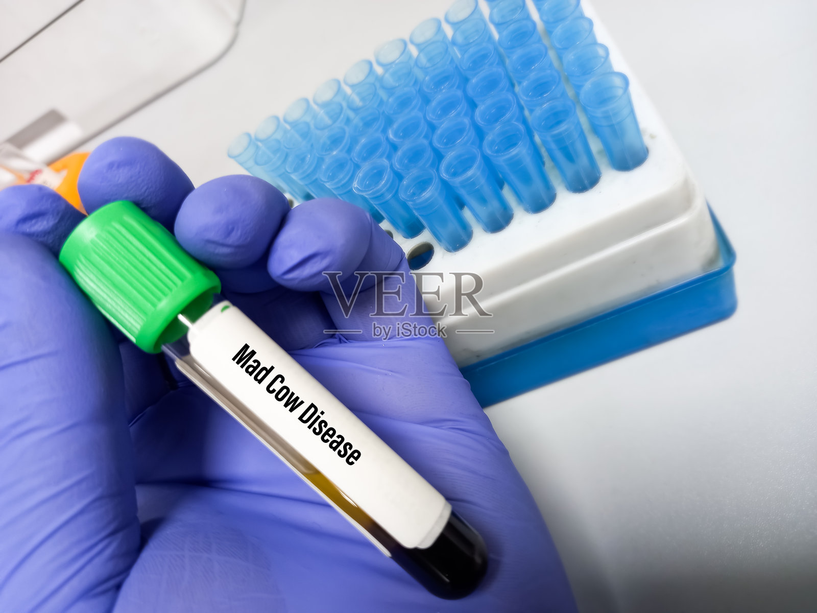 血液样本进行疯牛病或牛海绵状脑病(BSE)测试。这是另一种被称为变异型克雅氏病(vCJD), CJD朊病毒病,致命的大脑退化性疾病照片摄影图片