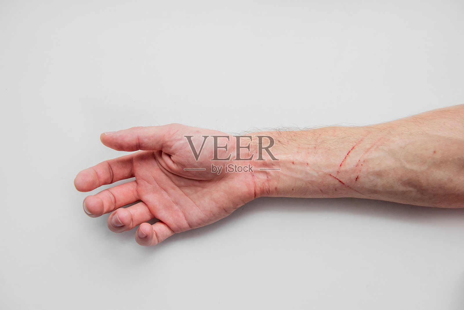 在白色孤立的背景上,男人的手被患狂犬病的猫抓伤。医疗护理过氧化氢照片摄影图片