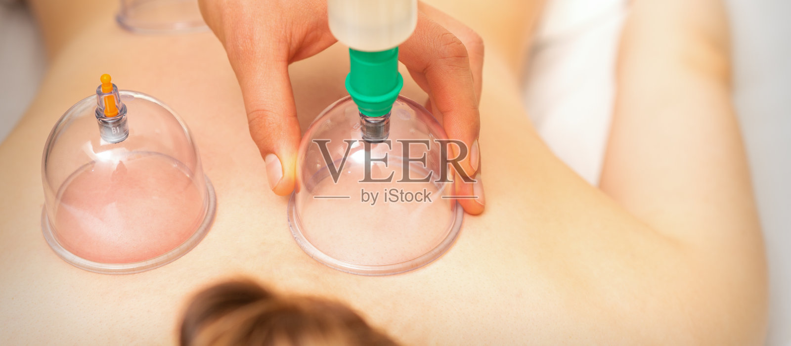 在按摩沙龙接受真空拔火罐治疗的妇女躺在胸部。照片摄影图片