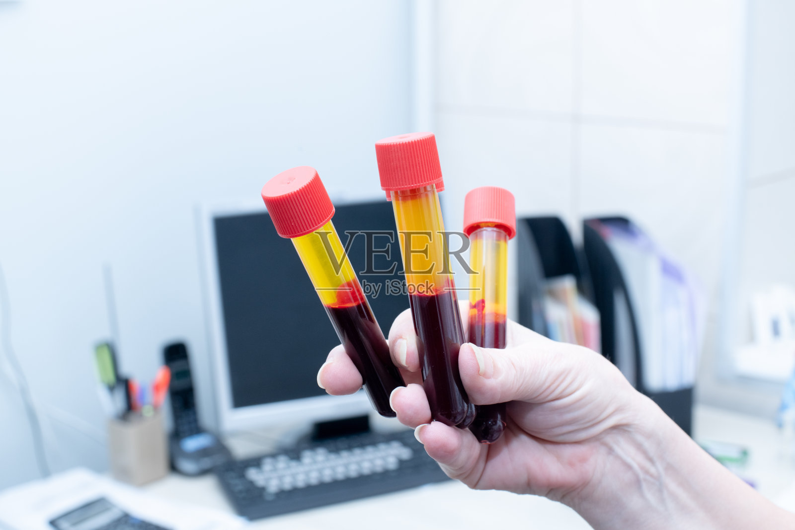 实验室医务工作者的手拿着真空管中的血液样本照片摄影图片