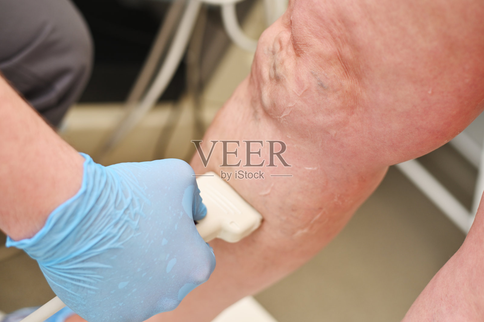 静脉医生对静脉曲张病人的静脉进行超声检查照片摄影图片