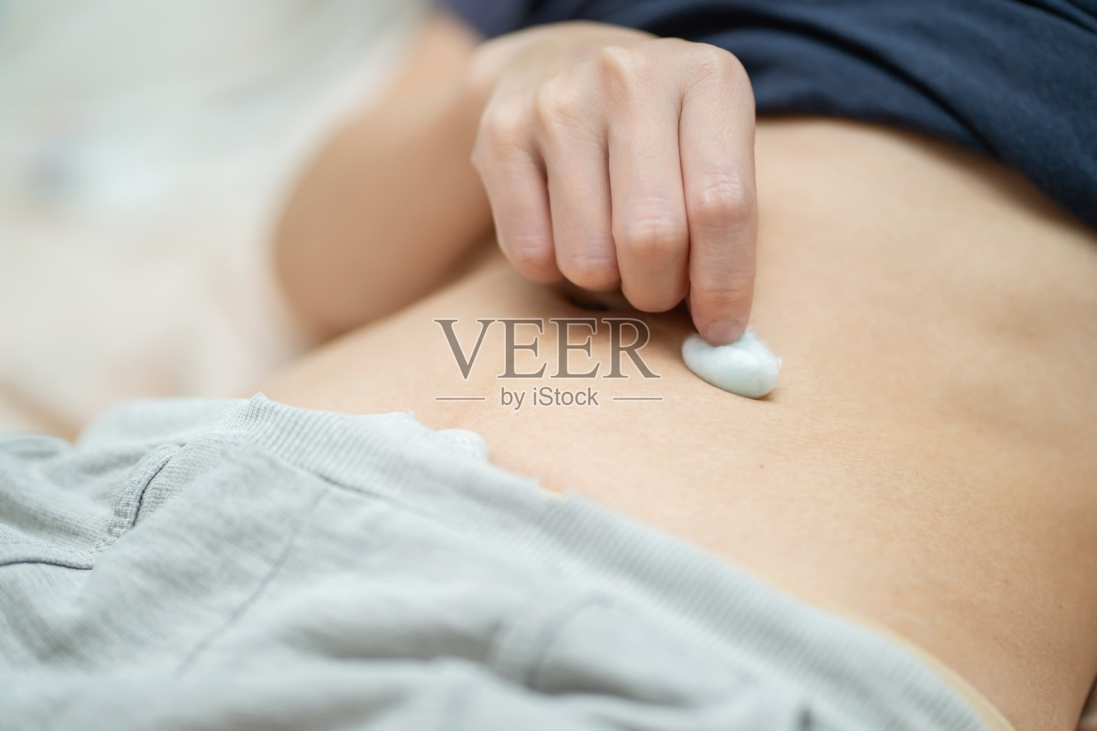 一名妇女用含酒精的棉球清洗胃前皮肤注射药物。体外受精的概念。人体外受精治疗注射激素怀孕。照片摄影图片