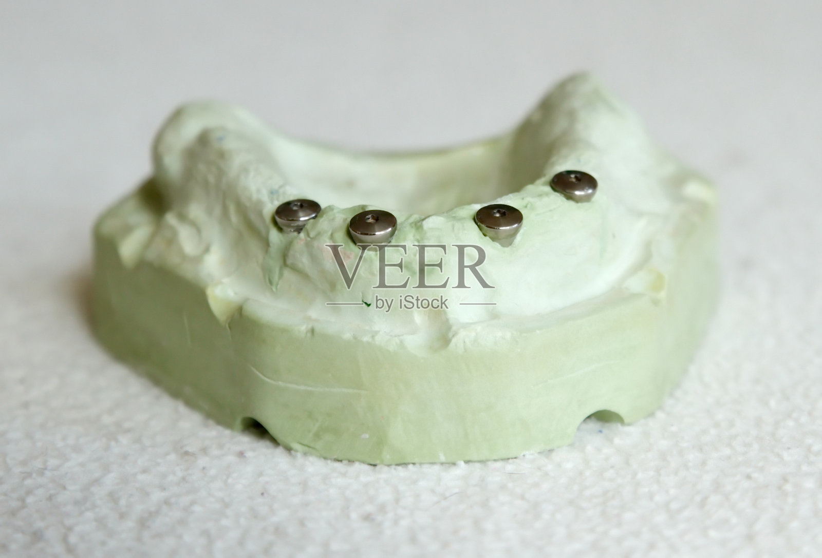 铸造四种种植体预备模型照片摄影图片