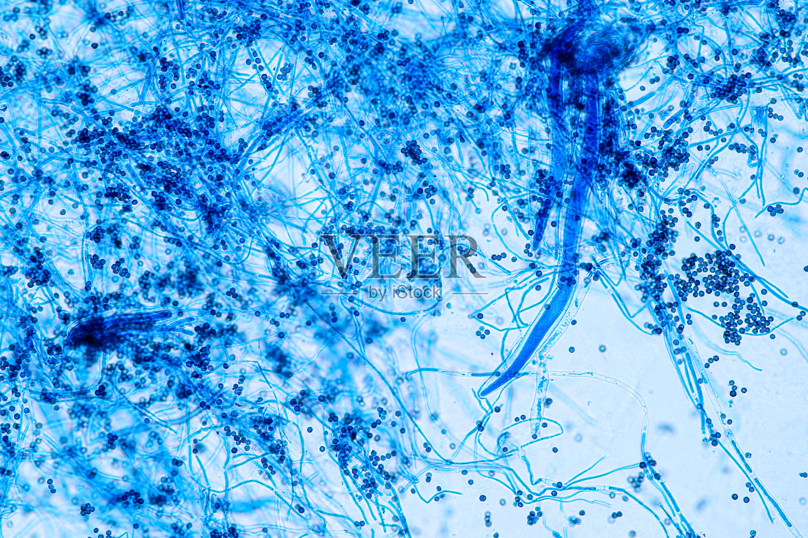 实验室微生物学显微镜下观察黑曲霉和米曲霉(霉菌)。照片摄影图片