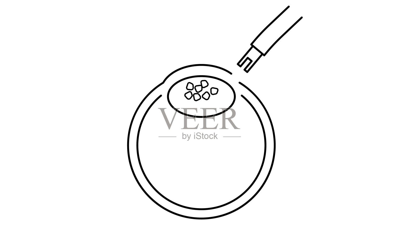 白内障手术过程,插图(划线),吸出浑浊的晶状体插画图片素材