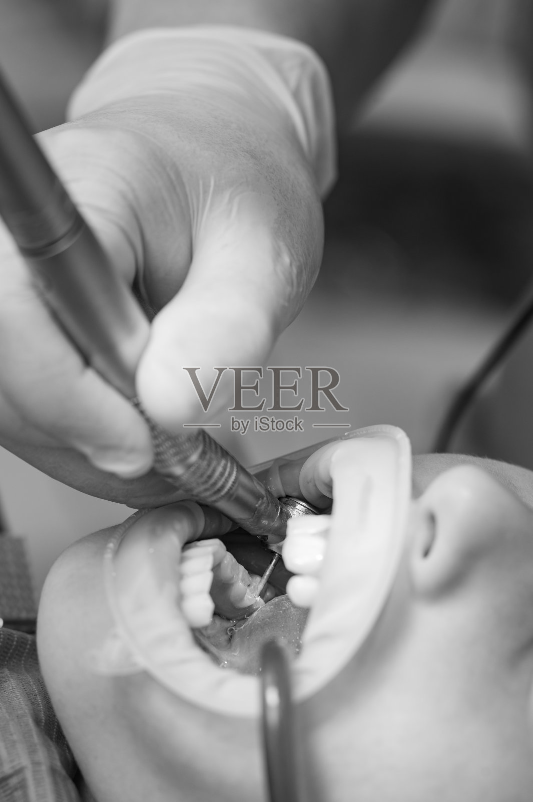 牙医用钻头清除儿童龋齿,将唾液喷射到儿童口中。照片摄影图片